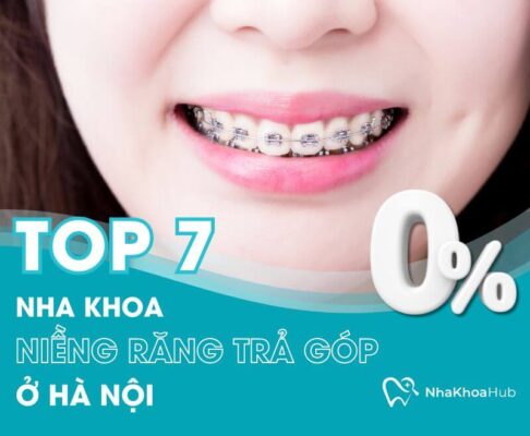 niềng răng trả góp ở Hà Nội