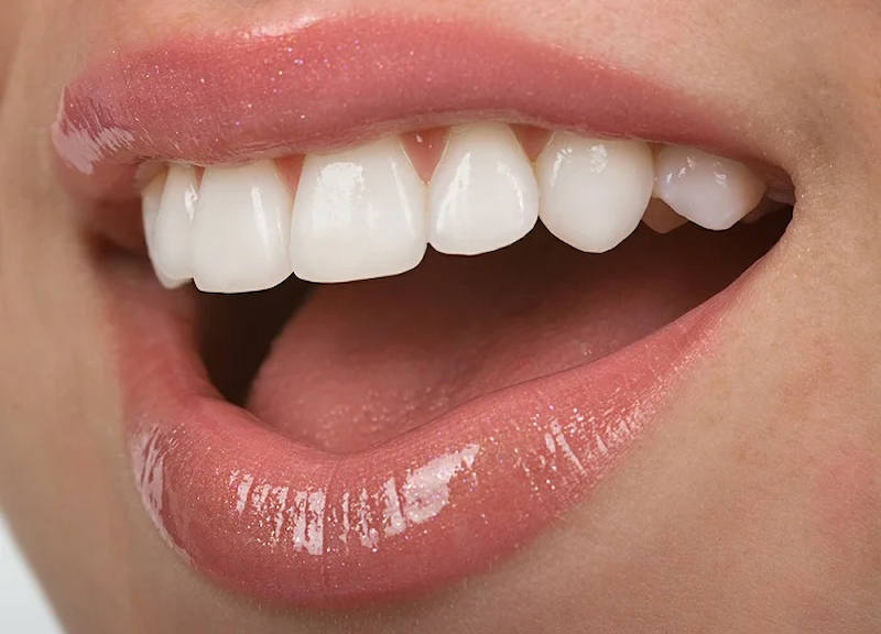 Các dịch vụ nha khoa Việt Nha đều được đánh giá cao