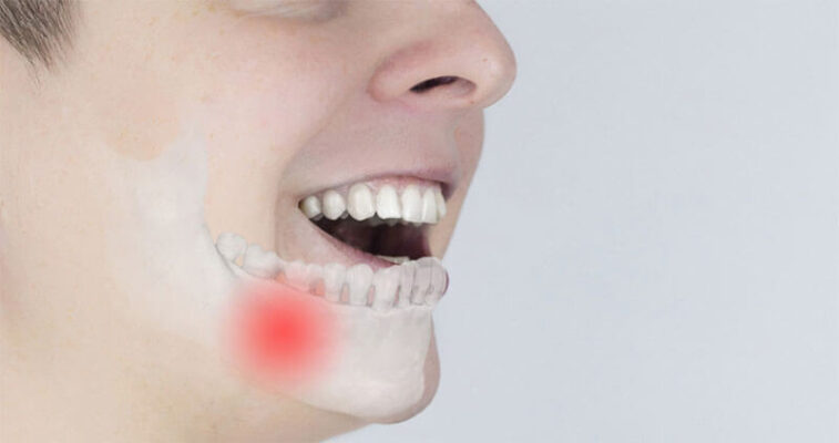 Viêm xương hàm tác động đến sức khỏe răng miệng