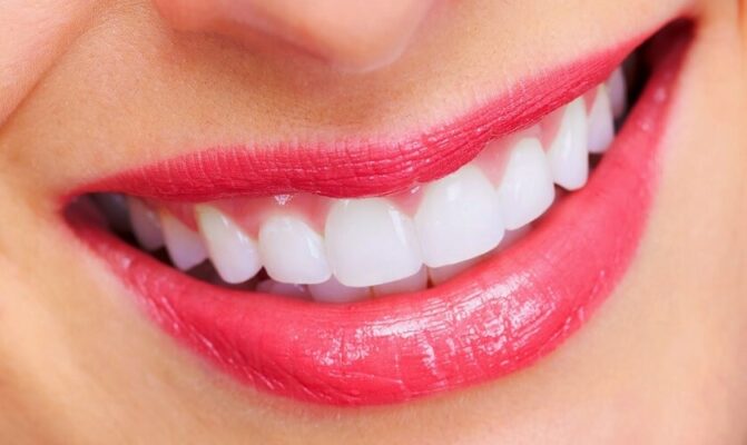 Người có răng cửa to thường lạc quan, vui vẻ, dễ dàng hòa nhập