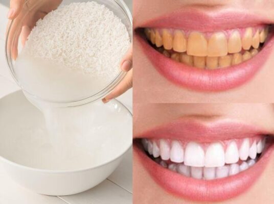 Đánh răng bằng nước vo gạo giúp cải thiện tình trạng răng ố vàng