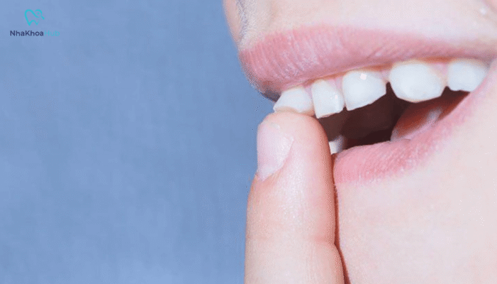 Viêm nha chu có thể gây tổn hại lớn đến răng miệng, khiến các cấu trúc hỗ trợ răng bị yếu đi