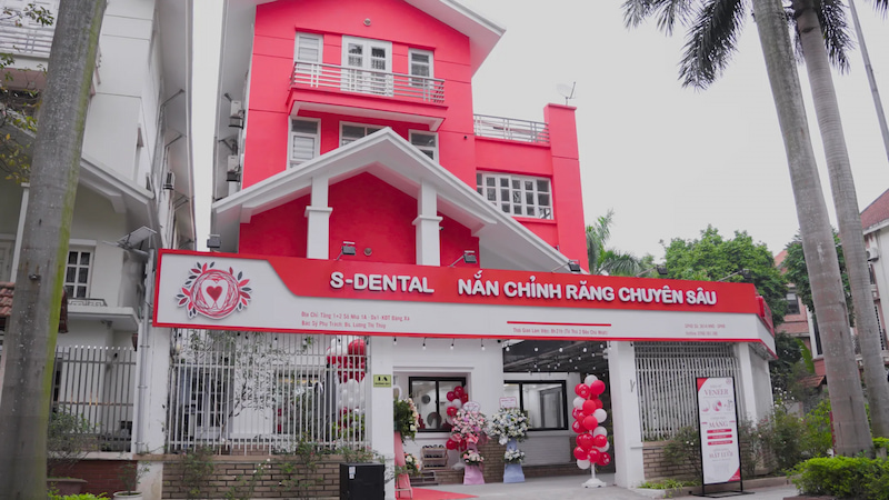 Nắn chỉnh răng chuyên sâu là dịch vụ nổi bật của S-Dental