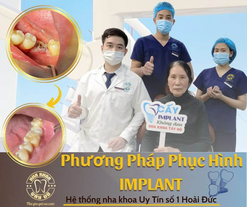 Cô Xuân quyết định chọn nha khoa Tây Đô ở Hoài Đức để trồng răng